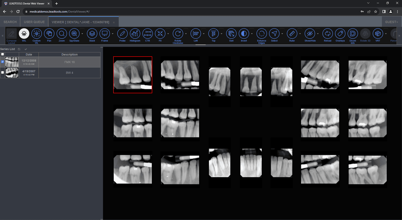 LEADTOOLS Medical Suite SDK（英語版） 商品画像
