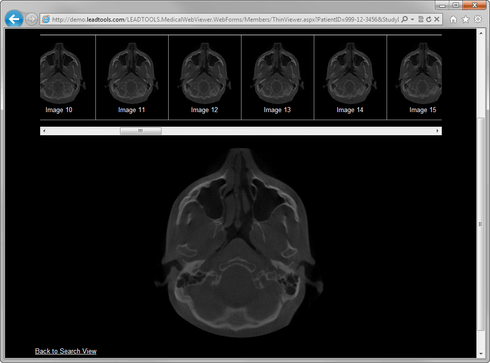 LEADTOOLS Medical HTML5 Moduleがラウンチ