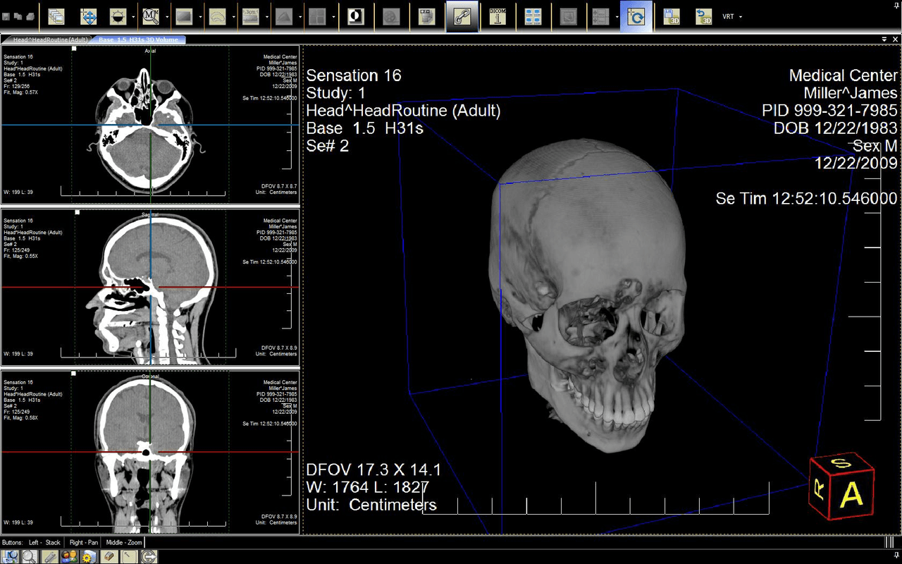 LEADTOOLS Medical Suite SDK（英語版） 商品画像