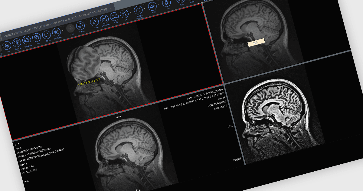 3DボリュームレンダリングでDICOM画像を表示